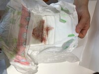 9ヶ月の赤ちゃんがいるのですが 今日初めてオムツに薄い血のようなシミがついて Yahoo 知恵袋