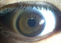 パーソナルカラー 瞳の模様について 画像は私自身の目です 懐中電 Yahoo 知恵袋
