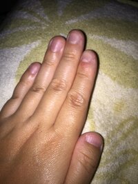 恥ずかしいのですが 深爪とはどんな爪のことを言うのですか 遺 Yahoo 知恵袋