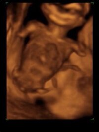 現在wの妊婦です この写真は16wの時の4dです 突起物ぽいのが見 Yahoo 知恵袋