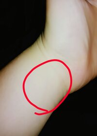 手首が痒いです 手首というより 動脈が痒いんです 湿疹は出来ていないし Yahoo 知恵袋