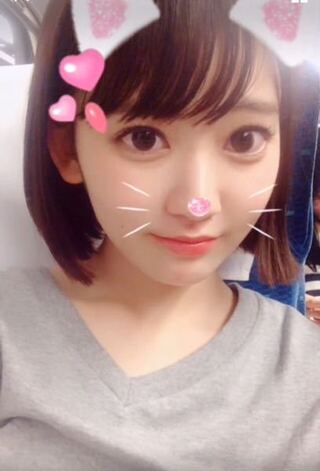 宮脇咲良ちゃんは整形モンスターと言われてきましたが オルチャ Yahoo 知恵袋