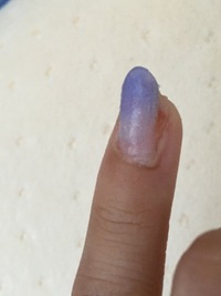 生爪を剥がしてしまいました ９月３日に不注意で小指の爪を剥がしました Yahoo 知恵袋