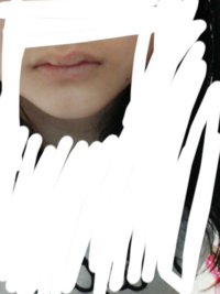 唇のしびれについて質問です 1週間くらい前から唇が少ししびれます しびれ自体は Yahoo 知恵袋