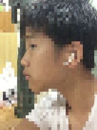 横顔ブスを治す方法私は鼻が低く 上唇が出ており 顎も長いのでよく怒っているのか Yahoo 知恵袋