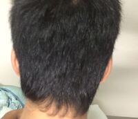 襟足が くるくるになってしまいます どうしたらまっすぐになりますか Yahoo 知恵袋