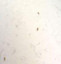 二週間前くらいから布団をコロコロすると 虫が付いてきます なので 週に一度布団を 教えて 住まいの先生 Yahoo 不動産