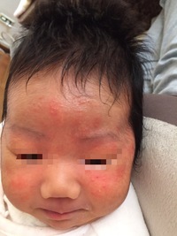 赤ちゃんの手形を取りたいのですが いつも手をグーにしていて Yahoo 知恵袋