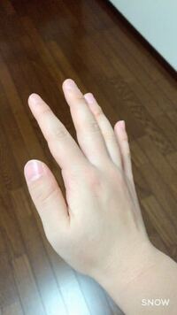 爪の形を治したいです 生まれつき爪が横長です そして 傾いていま Yahoo 知恵袋