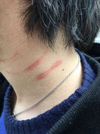 自分は親に殺されかけました 記憶の中で1番古いものは幼稚園のころ Yahoo 知恵袋