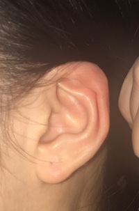 耳の形が変なんですがどうしたらいいでしょうか自分は福耳で 耳の形も Yahoo 知恵袋