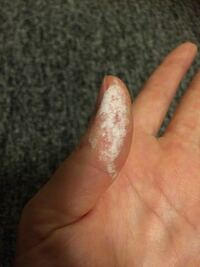 昨日突然指先が白くなりました 少し痒かったので 液体に触った Yahoo 知恵袋