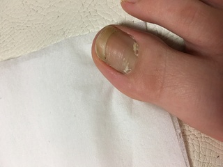 この爪は二枚爪というものでしょうか また 爪の根元の白いもの Yahoo 知恵袋