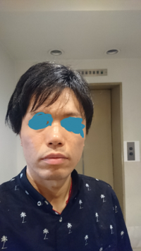 スマホのフラッシュを直視すると 目に悪いですか 悪いです 網膜を傷めま Yahoo 知恵袋