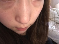 目の下のクマというより へこみ くぼみ がとても気になります Yahoo 知恵袋