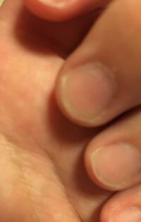 こんな変な形の爪でもスカルプで長さだしはできますか 綺麗な縦長な爪にし Yahoo 知恵袋