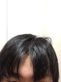 全体スカスカ薄毛の方いませんか どんな髪型にしてますか 全スカという Yahoo 知恵袋
