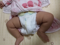 股関節脱臼について 生後3ヶ月の娘ですが太もものシワが左右 Yahoo 知恵袋