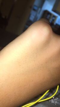 閲覧注意です 私は顔の毛穴が気になります この毛穴をなくす方法 Yahoo 知恵袋