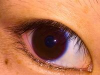 瞳のまわり 縁 の色って皆さん青いですか さっき鏡を見てみたらそうな Yahoo 知恵袋