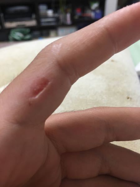 犬 に 噛ま れ たら 何 科 犬や猫などの動物に噛まれたら 注意したい感染症は 病院は何科に行くべき