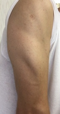 腕 肘の上 を太くしたい 私は肘から前 手首側 の筋肉がまあまああるの Yahoo 知恵袋