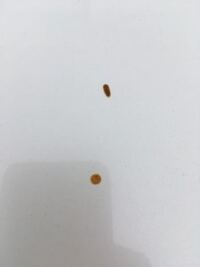 車ボディの茶色いシミについて分かりにくいですが 画像のような茶色 Yahoo 知恵袋