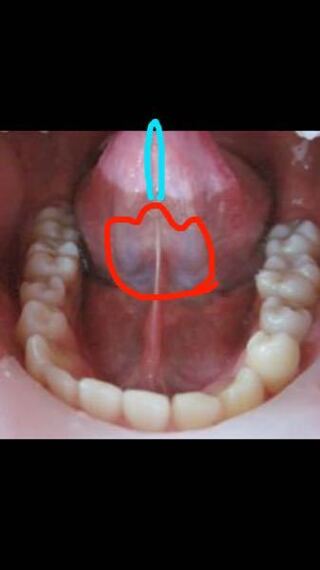 舌ピアスセンタータンについて質問させて頂きたいと思います 舌ピア Yahoo 知恵袋