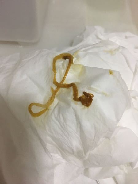 えのき 寄生虫 に関するq A Yahoo 知恵袋