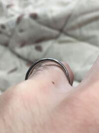 結婚指輪が緩いように感じます 指輪を指に押すとこれだけ空 Yahoo 知恵袋