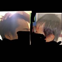 11年前と現在のおでこです これは天然剃り込みですか 後 Yahoo 知恵袋