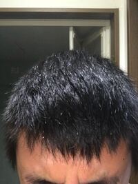 リンスで茶髪 リンスで茶髪にしようと思ってます そこで質問です1 Yahoo 知恵袋