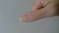 除光液でマニキュアを落とした後の白いカスってどうしてできるのでしょうか Yahoo 知恵袋
