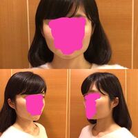 私は顔の輪郭がコンプレックスで仕方ありません 小さい頃からエラが張って Yahoo Beauty