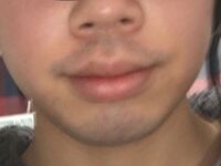 大学生鼻の下髭濃い青い大学1年生男です 浪人したので19歳 もうじき Yahoo 知恵袋