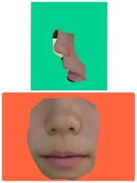 鼻の大きさって 遺伝するのでしょうか ネットではわ鼻の高さは Yahoo 知恵袋