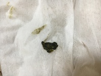 深緑色の赤ちゃんのうんちについてお尋ねします 生後2ヶ月の赤ちゃん Yahoo 知恵袋