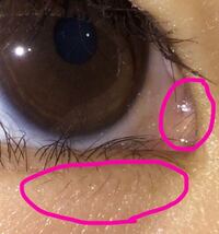 目頭と目の中のギリギリにまつ毛が映えているようで 目が気持ち悪いです 抜こう Yahoo 知恵袋