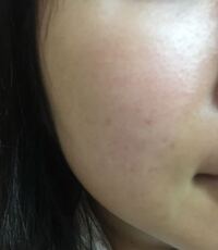 すっぴんで無加工です 肌の評価してください Yahoo 知恵袋