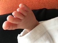 赤ちゃんの爪が割れます 生後8ヶ月の子供がいます ズリバイで活発に動く Yahoo 知恵袋