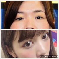 整形で大久保佳代子さんみたいな目の人が古川優香ちゃんみたいな目になるこ Yahoo 知恵袋