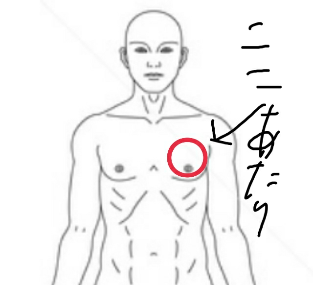 左鎖骨下 に関するq A Yahoo 知恵袋