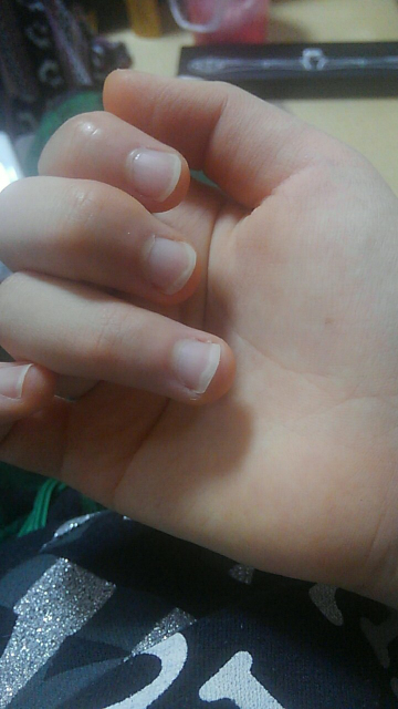 また爪のピンク色の部分が減りました どうしてなのでしょう 本当に Yahoo 知恵袋