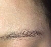 閲覧注意です 写真あります 私はアトピーを持ってい Yahoo 知恵袋