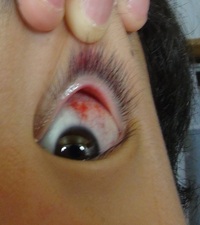 昨日目を爪で引っ掻いてしまって一部赤くなり 目薬がしみたり まぶたの上 Yahoo 知恵袋