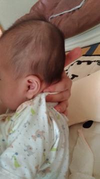 赤ちゃんの頭の形について もうすぐ２ヶ月になる女の子なんです Yahoo 知恵袋