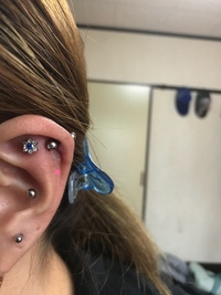 ニードルで開けた時毎回少し血が出るのですが開け方が下手なんですか Yahoo 知恵袋