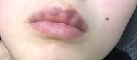 キスで唇が青く 青紫 なる事はありますか 強く吸い続けたりすると Yahoo 知恵袋