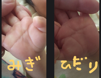 うちの息子は両手ますかけ線ですか 5月に出産して1ヶ月検診 Yahoo 知恵袋
