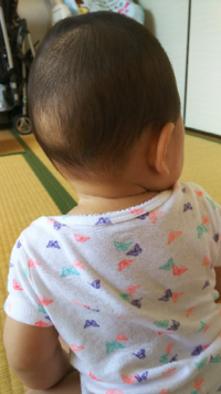 赤ちゃんの頭の形について質問です 9ヶ月の赤ちゃんですが Yahoo 知恵袋
